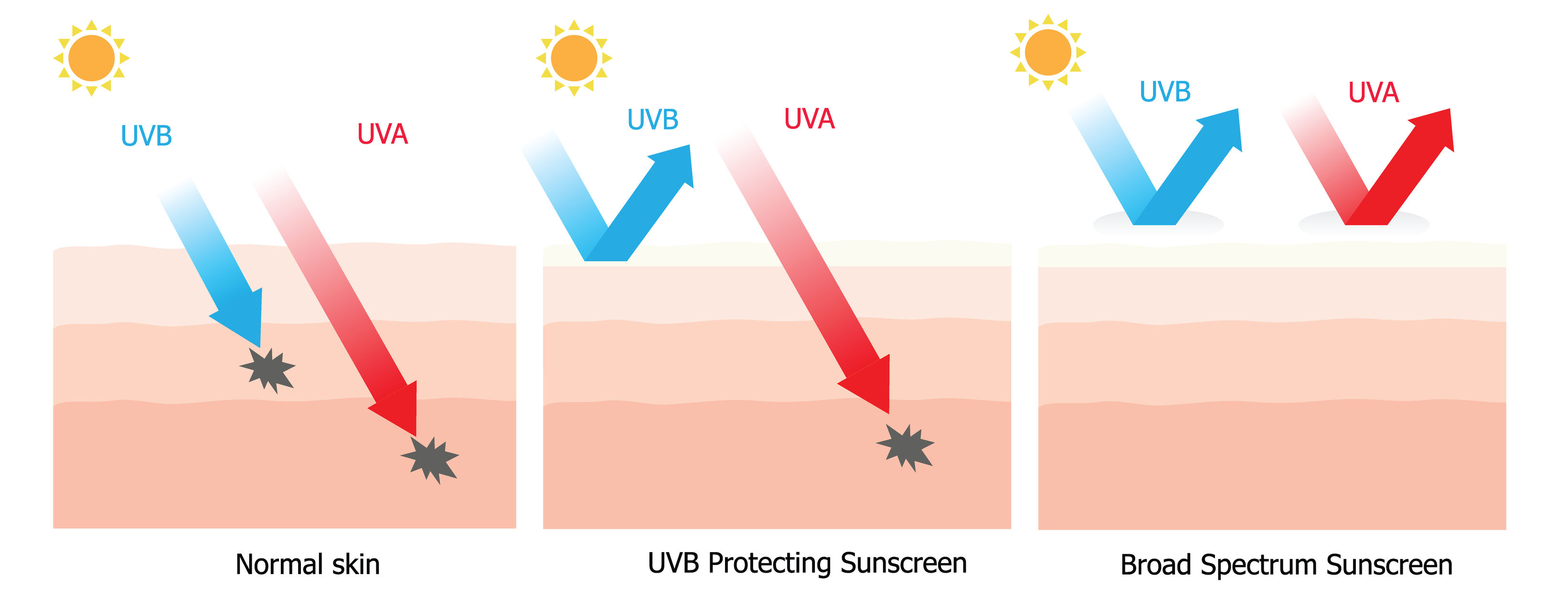 Пропускает ли стекло солнце. UVA UVB фильтры. Физические и химические фильтры SPF. Кожи от лучей UVA И UVB. UVA UVB лучи что это.